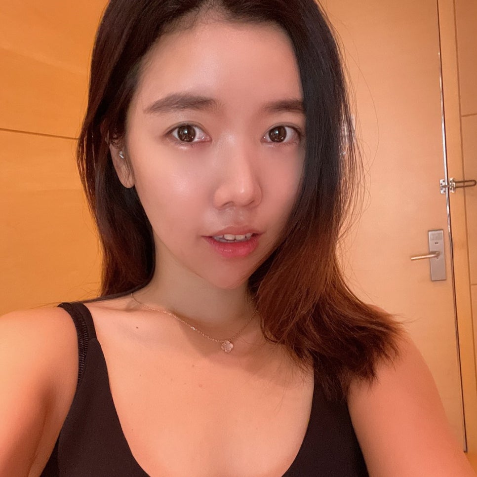 원조는 넥슬림주사전후 부터 다르네요 관련 이미지 1