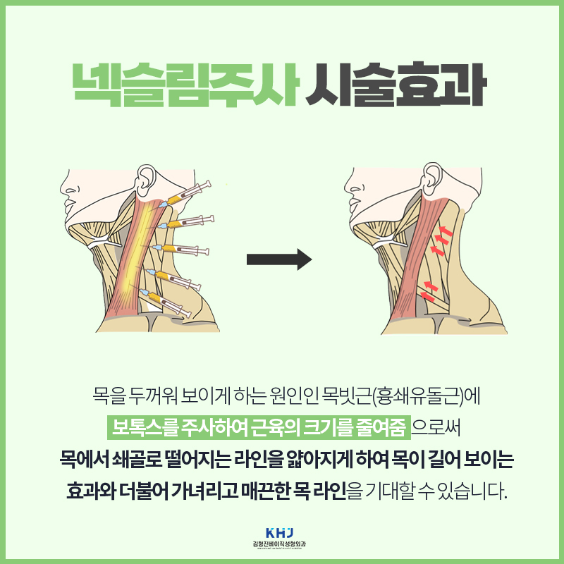 넥슬림주사전후 목부터 어깨까지! 완벽한 라인을 만드는 방법 관련 이미지 4