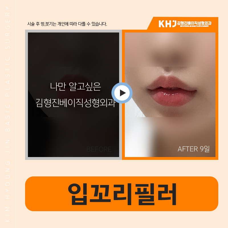 입꼬리올리는법 이거 하나만 해도 충분합니다! 관련 이미지 6