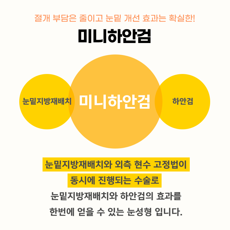 중년눈밑수술병원 안전하게 잘하는 곳 관련 이미지 3