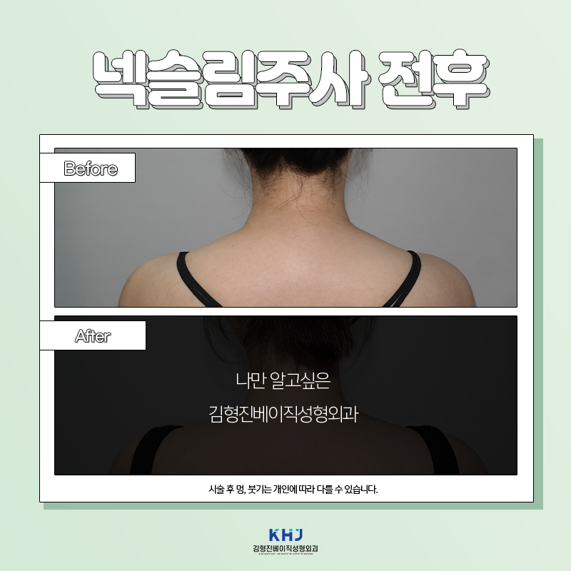 웨딩관리 김형진베이직에서 해야하는 이유? 관련 이미지 5