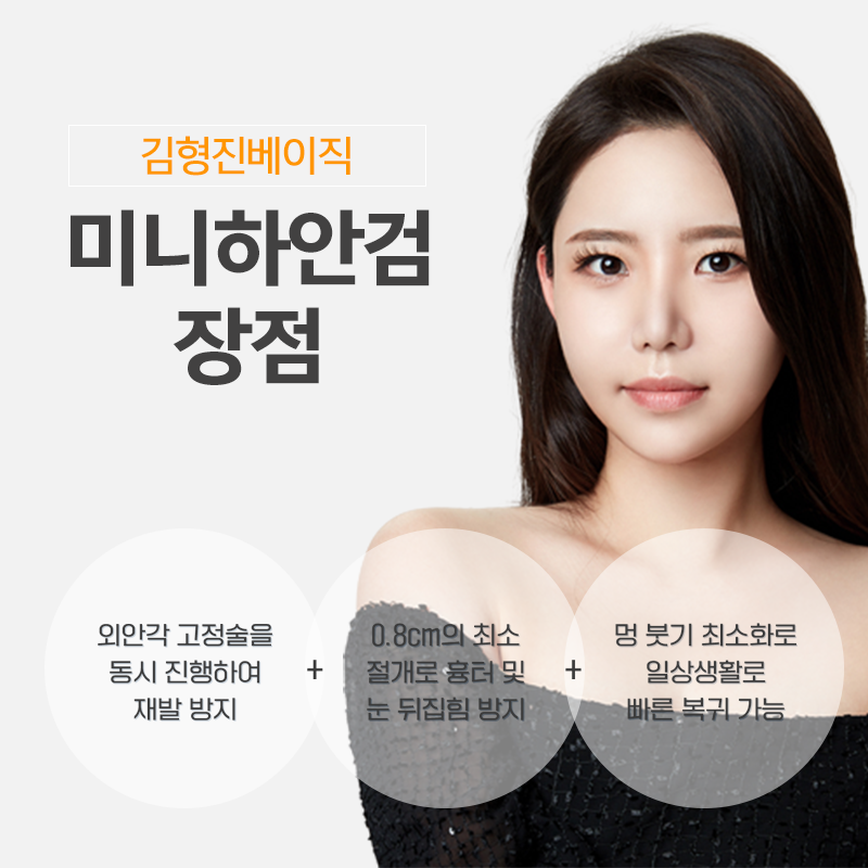 중년눈밑수술 김형진베이직에서 하셔야죠! 관련 이미지 4