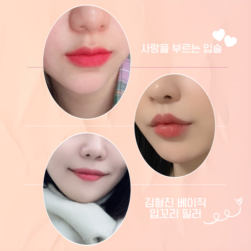 입꼬리필러시술로 자연스럽게 미소 띈 인상을 만들어요! 관련 이미지 5