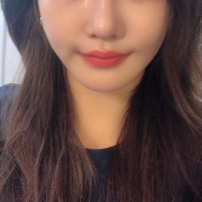 강남입꼬리필러 어디가 잘하는지 모르겠다면 관련 이미지 2