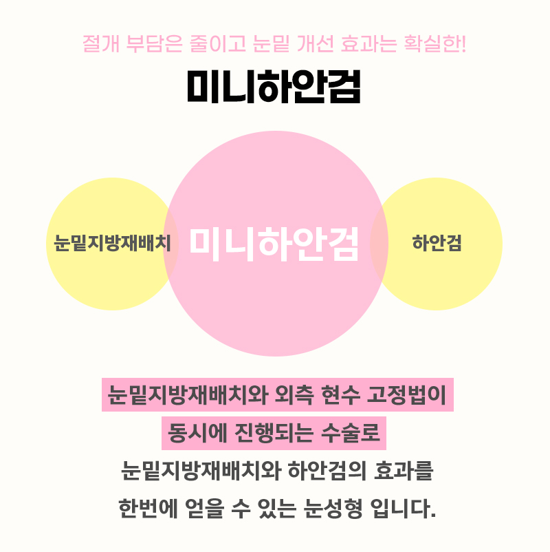 미니하안검효과에 만족할 수 밖에 없는 이유 관련 이미지 3