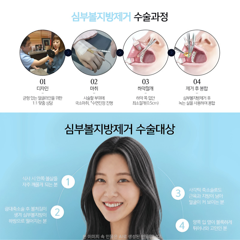 심부볼지방제거로 얼굴형 고민 해결했어요! 관련 이미지 5