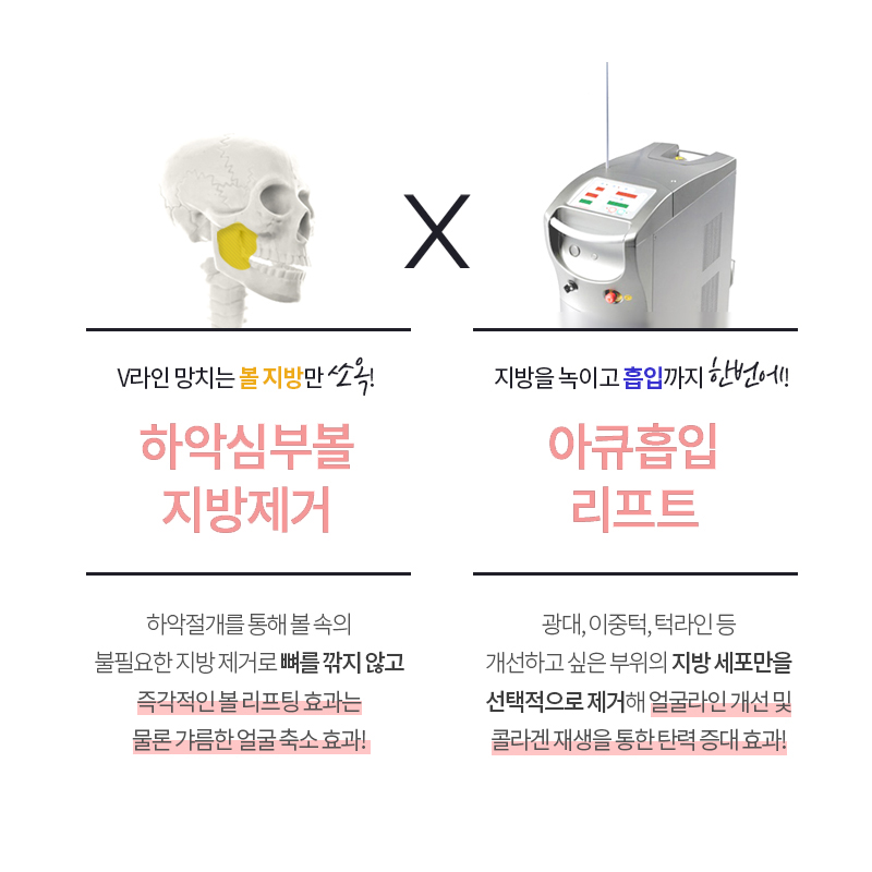 얼굴지방흡입효과 확실한 차이 보고가세요! 관련 이미지 6