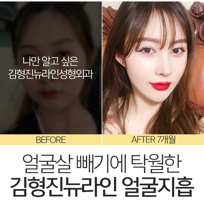 얼굴살빼는법 이렇게나 쉽다니 관련 이미지 7