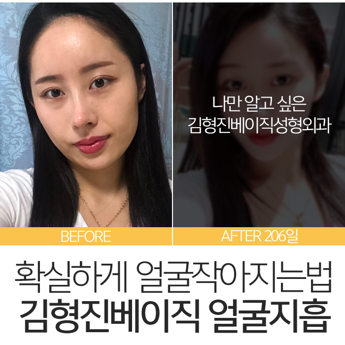 얼굴작아지는법 김형진베이직에서는? 관련 이미지 3