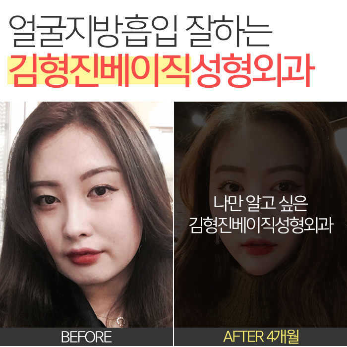 얼굴작아지는법 이것저것 하지말고 하나만 딱! 관련 이미지 6