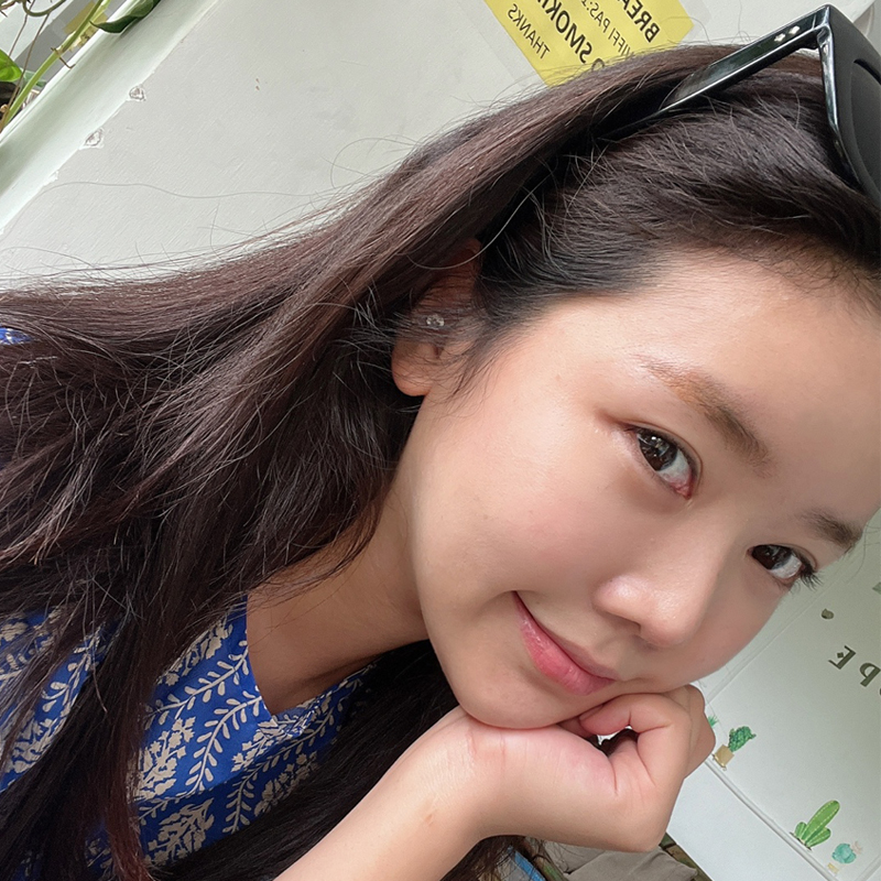 이중턱지방흡입흉터 안 보여요! 관련 이미지 6