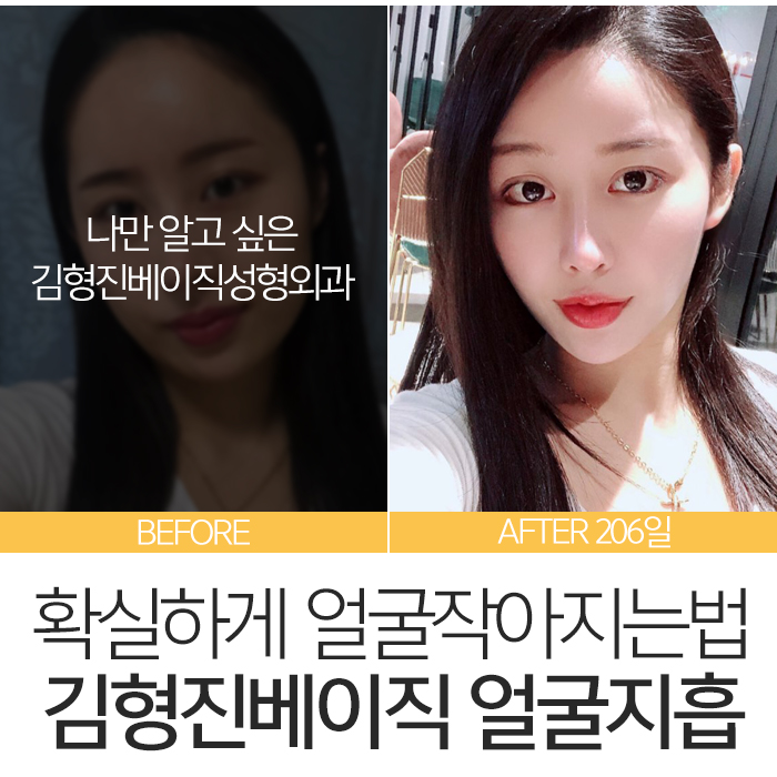얼굴작아지는법 김형진베이직에서는? 관련 이미지 2