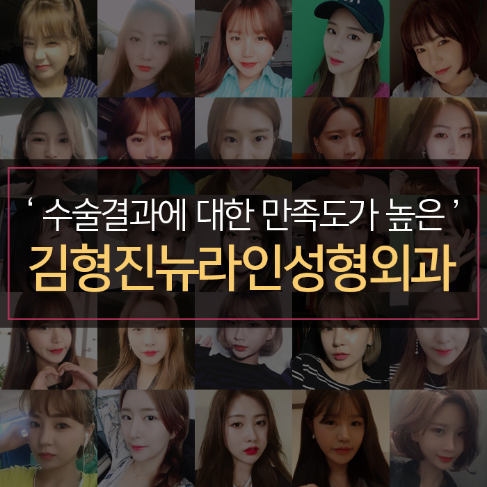 처진볼살교정 하고싶다면 관련 이미지 6