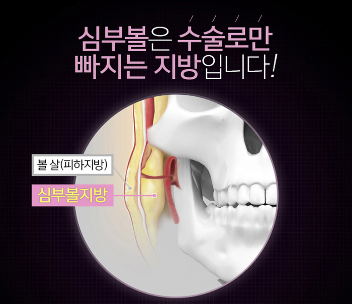 땅콩형얼굴 고민만 하고 있나요? 관련 이미지 4