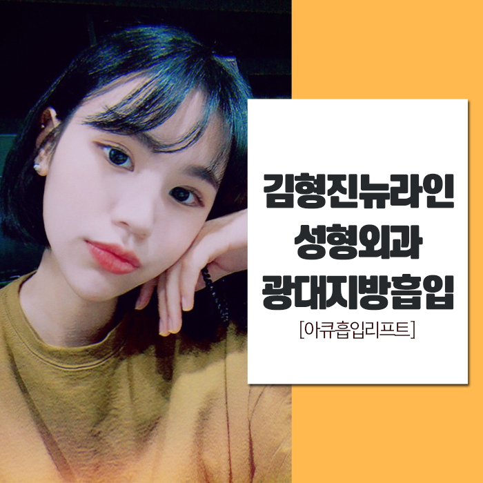 광대살지방흡입 이렇게 하는 거였어? 관련 이미지 1