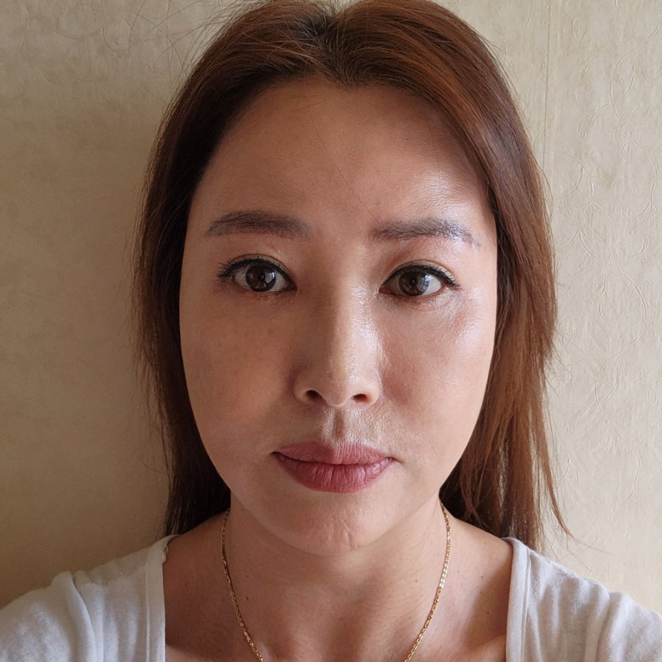 중년눈수술병원 어느 병원이 좋을지 모르겠다면 관련 이미지 1