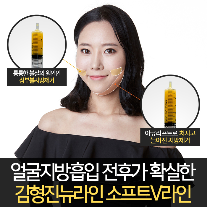 얼굴지방흡입전후 제대로 보려면 관련 이미지 4