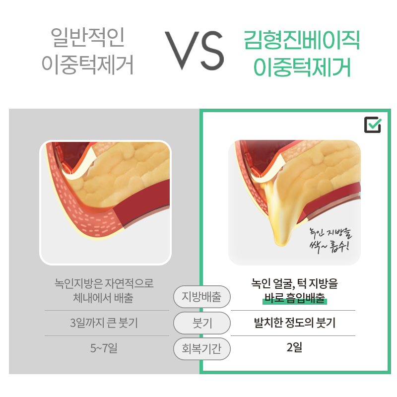후덕한 턱살제거 고민이라면 관련 이미지 4