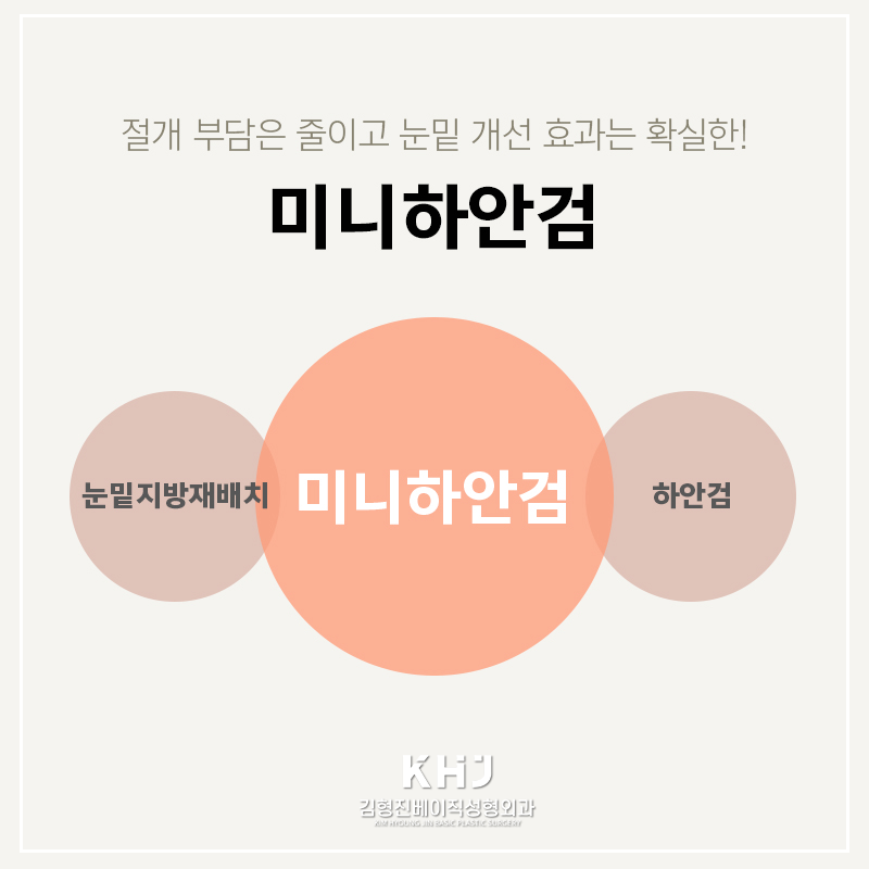 미니하안검흉터 걱정되시죠? 관련 이미지 2