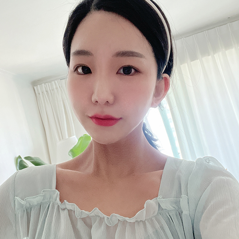 입꼬리필러리터치 김형진에서 하는 이유는요 관련 이미지 3