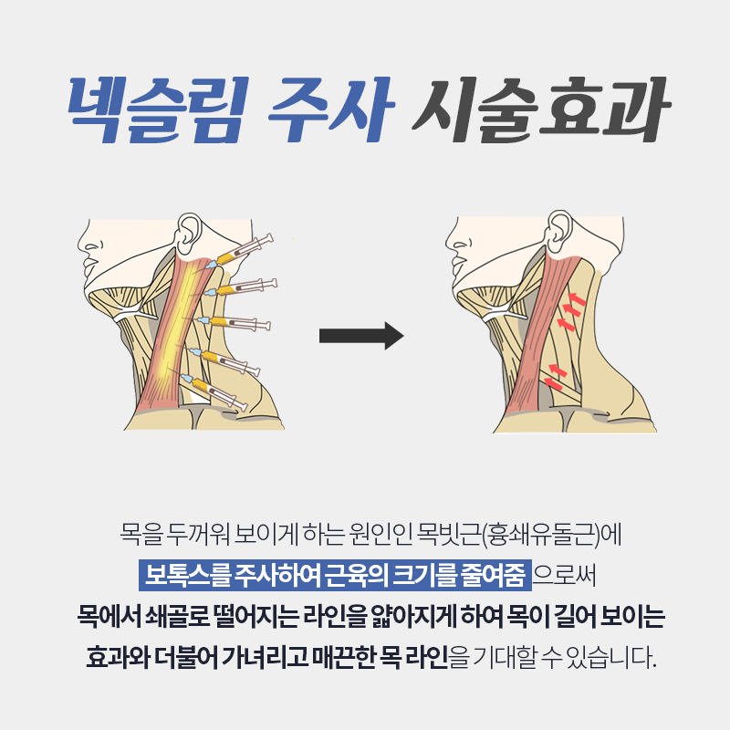 목보톡스 진짜는 김형진베이직인거 아시죠 관련 이미지 4