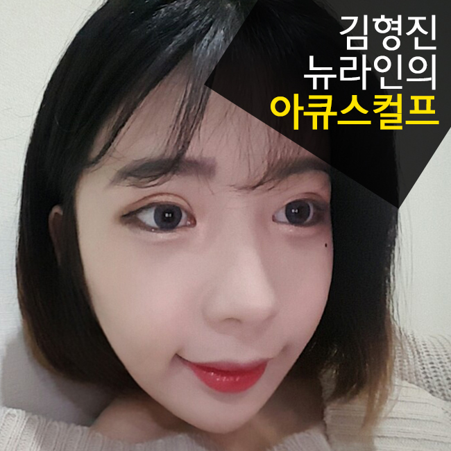 얼굴살흡입으로 V라인이 가능 :: 김형진뉴라인성형외과 관련 이미지 1