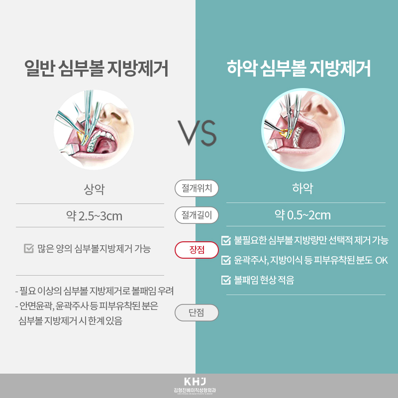 심부볼제거잘하는곳 찾고 계셨다면! 관련 이미지 5