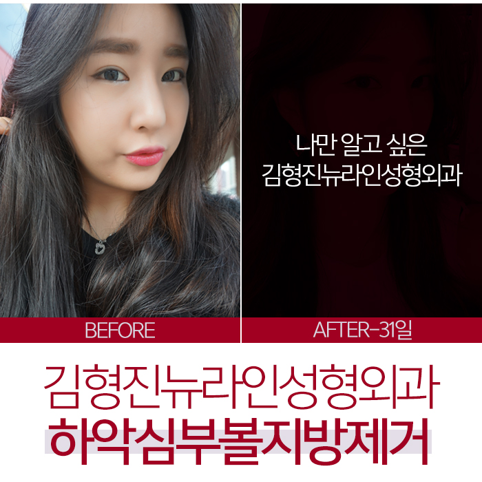 볼살없애는법 그동안 잘못 알고있던 사실 관련 이미지 3