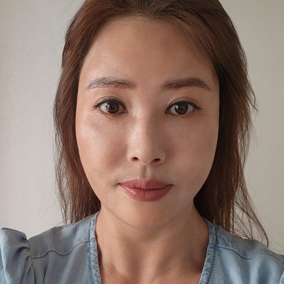 중년눈성형 고려 중이라면 김형진베이직에서! 관련 이미지 1