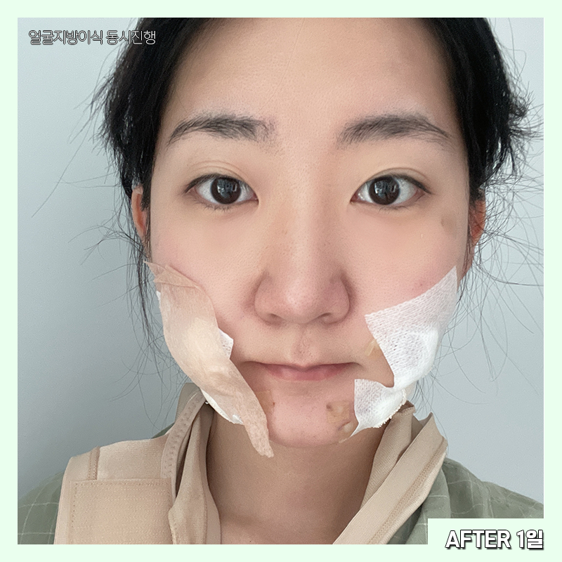 얼굴살빼는법 이렇게 간단한 방법이? 관련 이미지 3