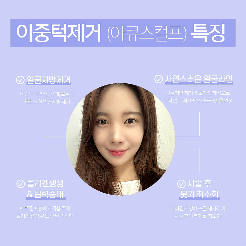 턱살지방흡입수술 받고 턱살 정리 끝! 관련 이미지 6