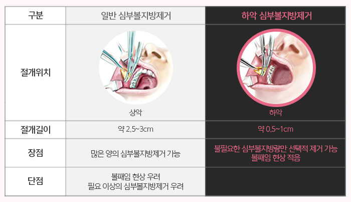 압구정심부볼제거 남다른 후기 관련 이미지 5
