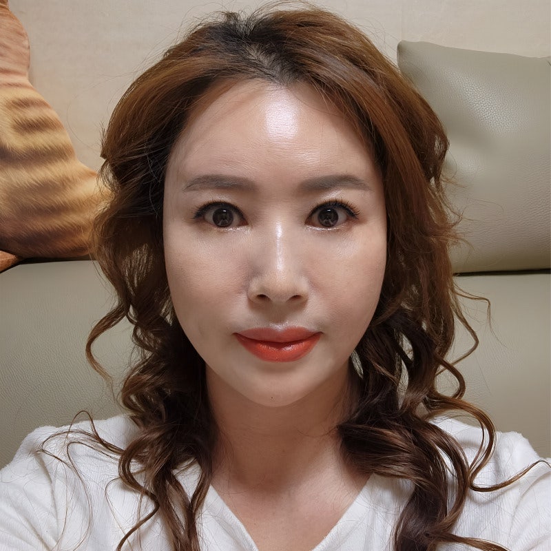 눈밑처짐수술로 나이 들어 보이는 노안 이미지 탈출했어요! 관련 이미지 2