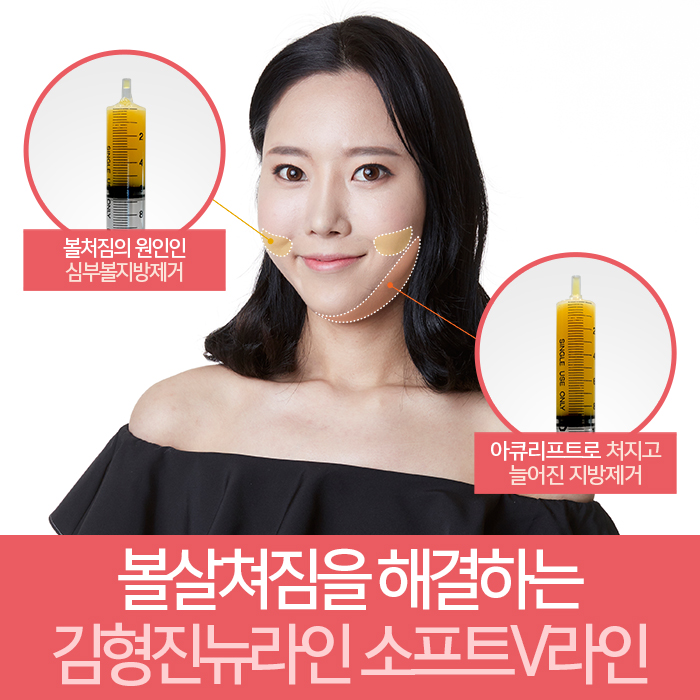 볼살쳐짐 어이 하늬? 관련 이미지 3