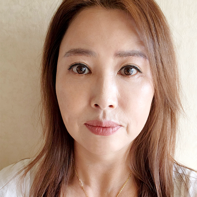 중년눈밑처짐 개선방법 알려드려요! 관련 이미지 1