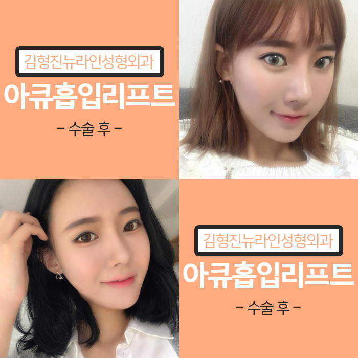 광대살빼기 어려운 게 아니네 관련 이미지 5
