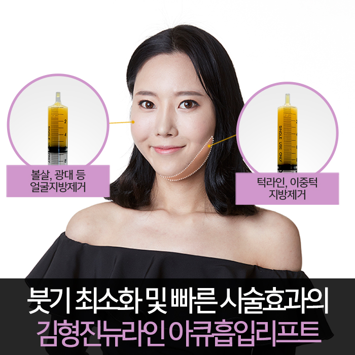 턱살지방흡입후기 확실한 곳 찾아요? 관련 이미지 6