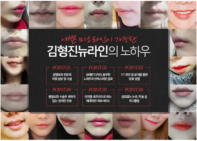입꼬리수술비용 보다 효율적인 방법은? 관련 이미지 4