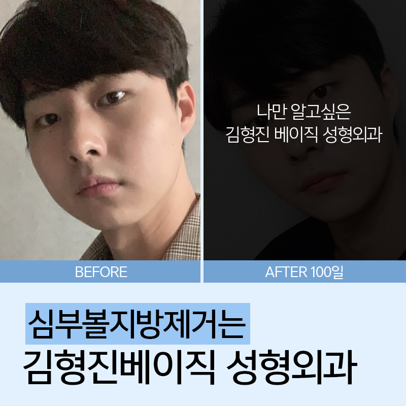심부볼패임 너무 걱정된다구요? 관련 이미지 2