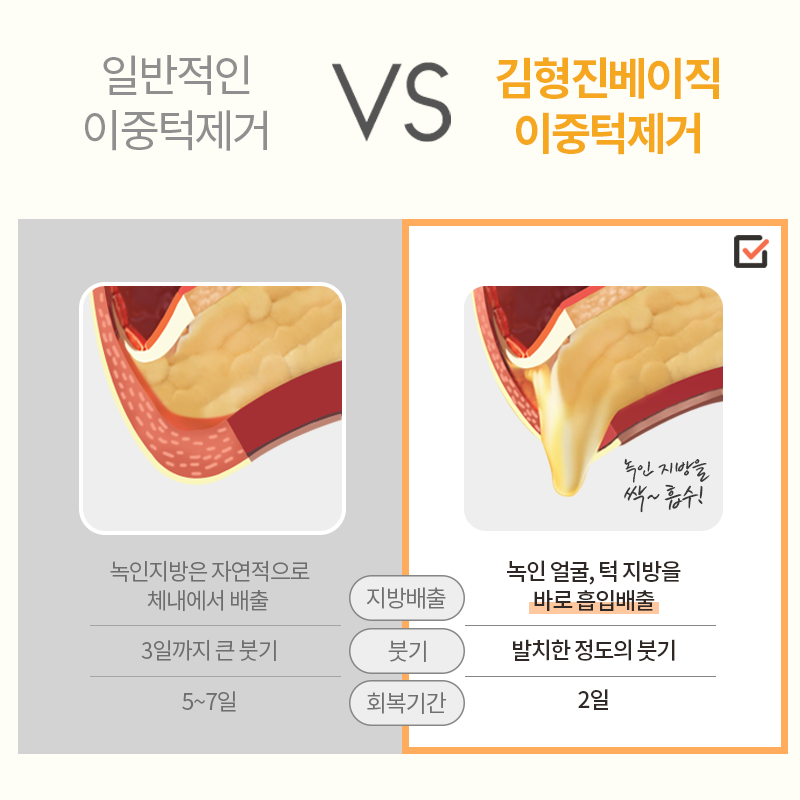 턱살빼는법? 알려드립니다~! 관련 이미지 4