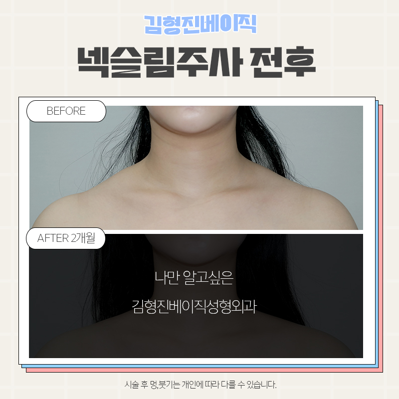웨딩관리는 김형진베이직에서 하셔야죠! 관련 이미지 4