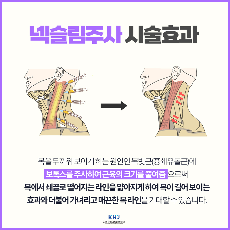 솔직한 넥슬림주사후기 목부터 어깨 라인까지 확 달라졌어요! 관련 이미지 4