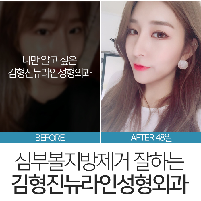 심부볼위치 정확하게 요기 관련 이미지 7