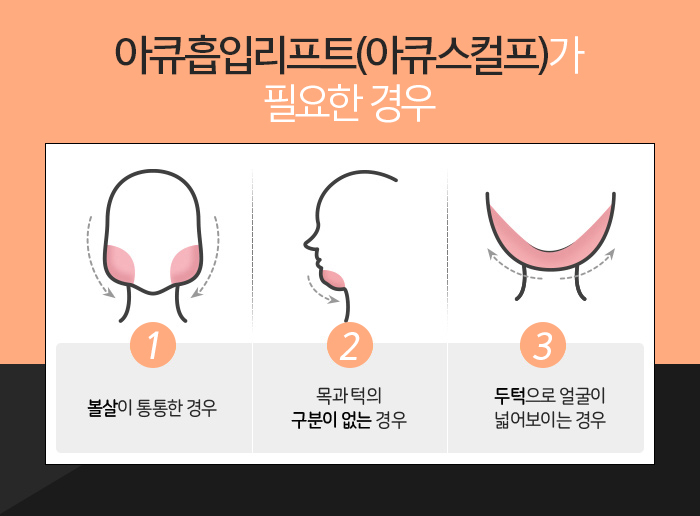 광대살빼기 어려운 게 아니네 관련 이미지 4