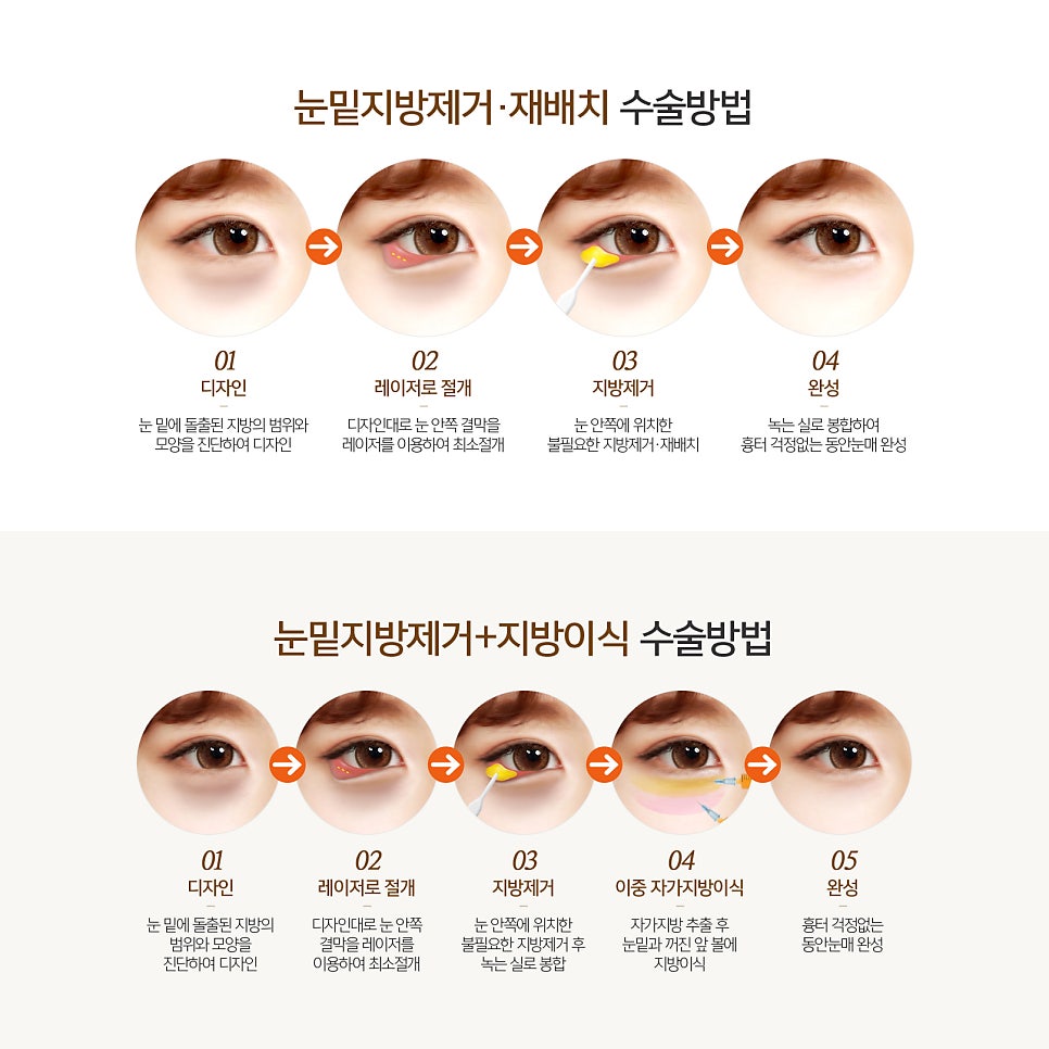 강남눈밑지 아무 데나 가면 안 돼요! 관련 이미지 5