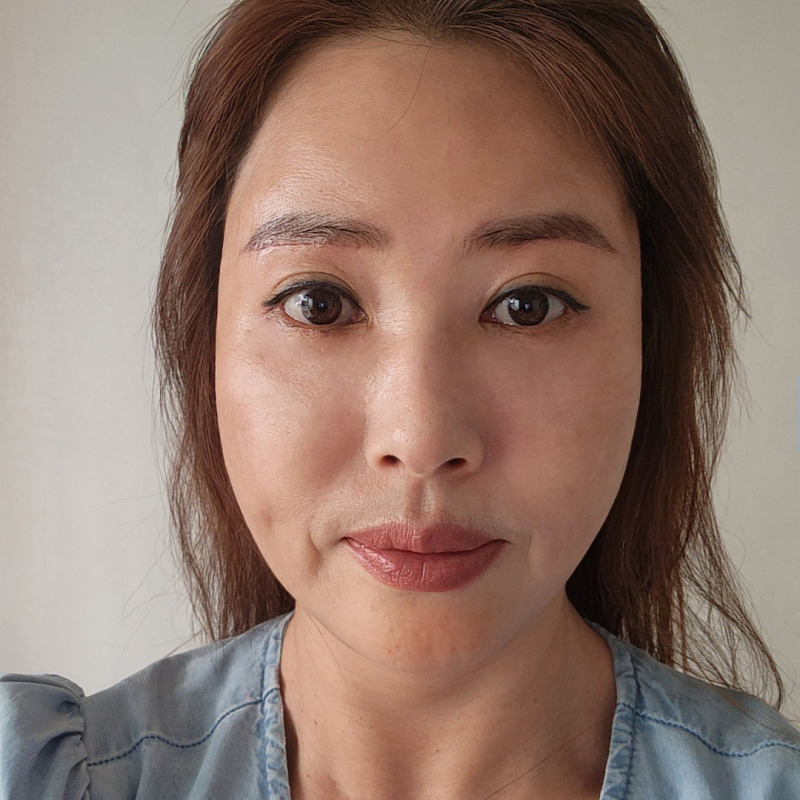 효도성형으로 젊음을 되찾아드리고 싶다면? 관련 이미지 2