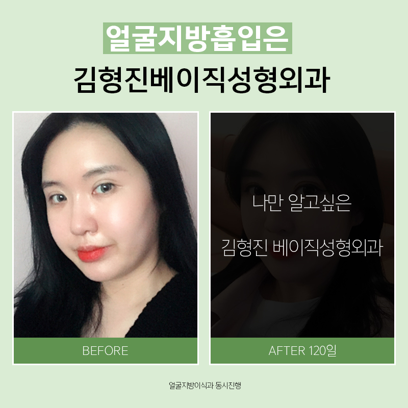 갸름한얼굴라인만드는법 쉬워요! 관련 이미지 5