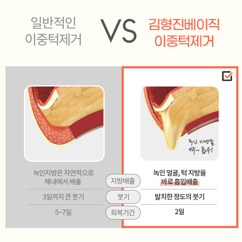 얼굴살빼는법 이렇게 빠르게 될 줄 몰랐어요... 관련 이미지 6