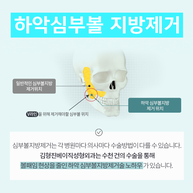 빠지지 않는 얼굴살없애는방법, 궁금하다면 관련 이미지 5