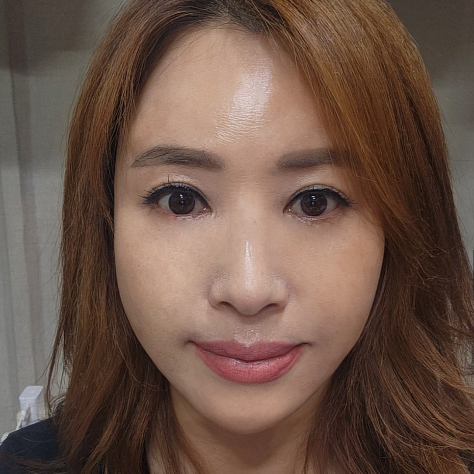 중년눈처짐수술 미니하안검으로 탄력 있게 관련 이미지 2